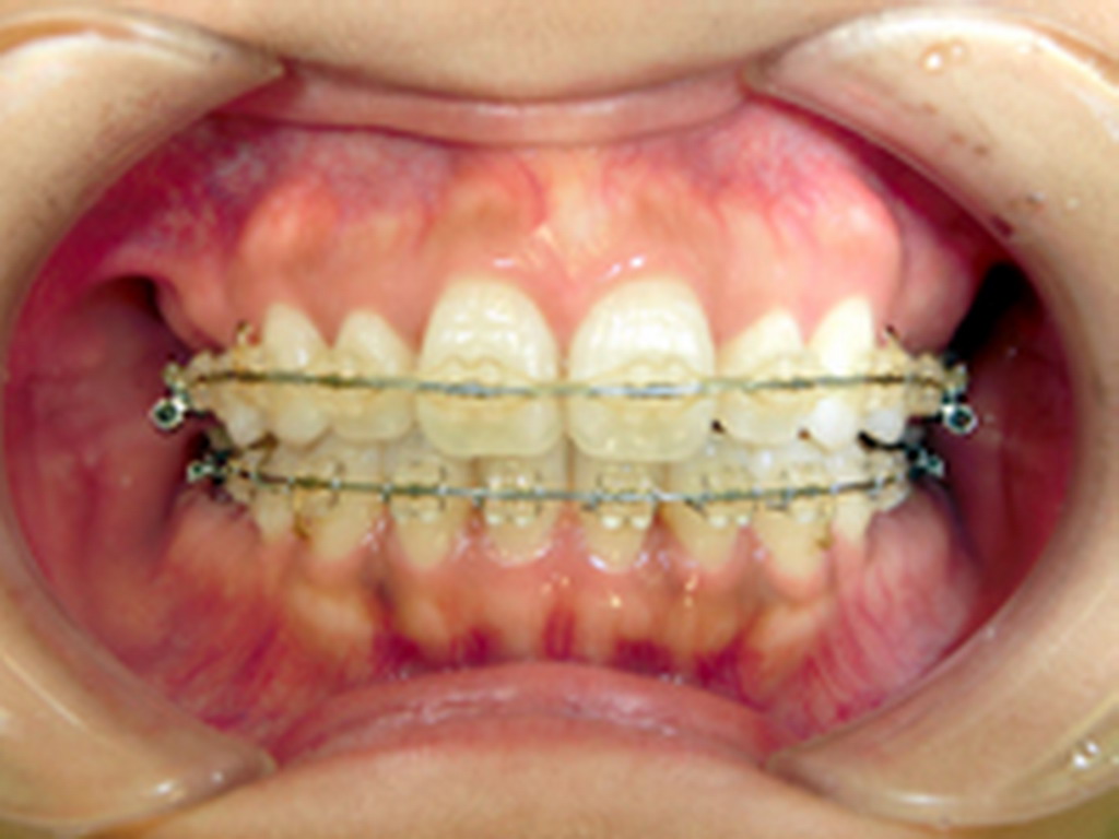 名古屋市中村区・いわま歯科クリニック