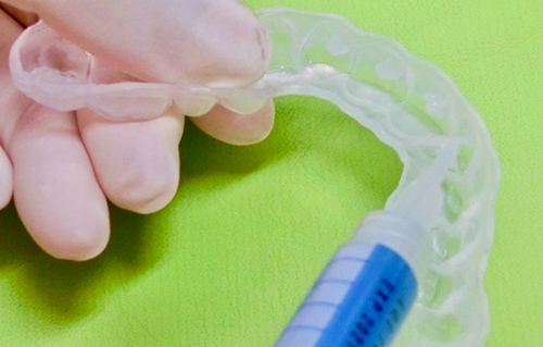 診断・治療プラン説明