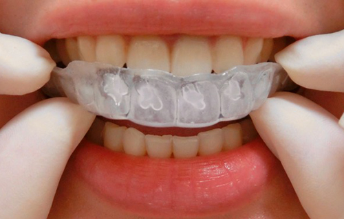 診断・治療プラン説明