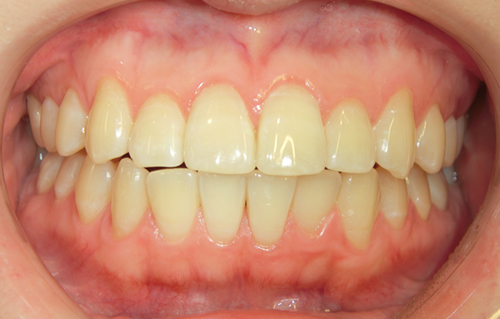 診断・治療プラン説明